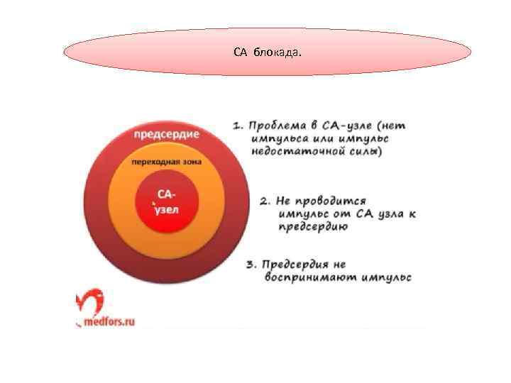 СА блокада. 