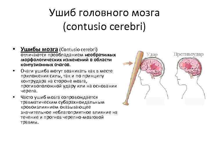 Ушиб головного мозга (contusio cerebri) • Ушибы мозга (Contusio cerebri) • • отличаются преобладанием