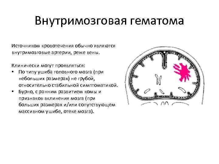 Внутримозговая гематома Источником кровотечения обычно являются внутримозговые артерии, реже вены. Клинически могут проявляться: •