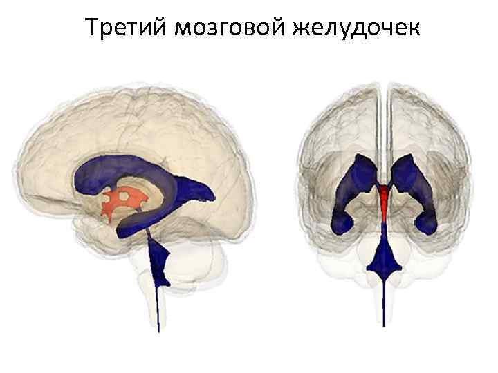 Третий мозговой желудочек 