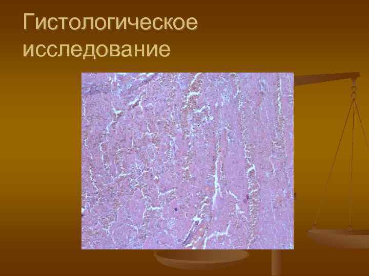 Гистологическое исследование 