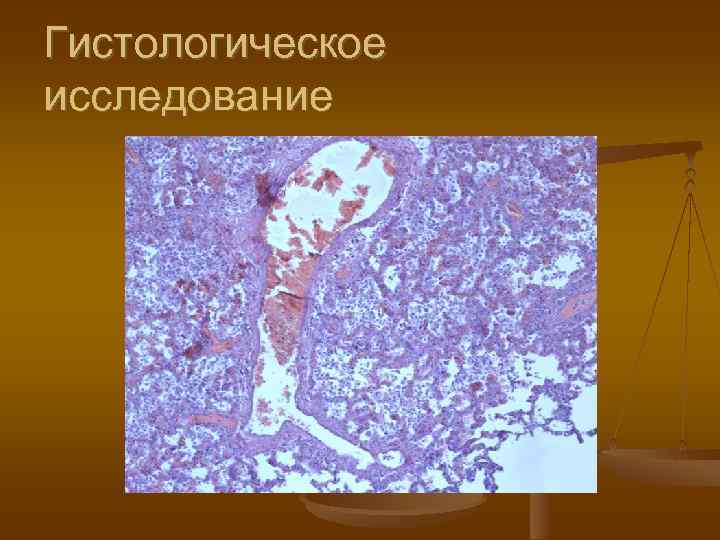 Гистологическое исследование 