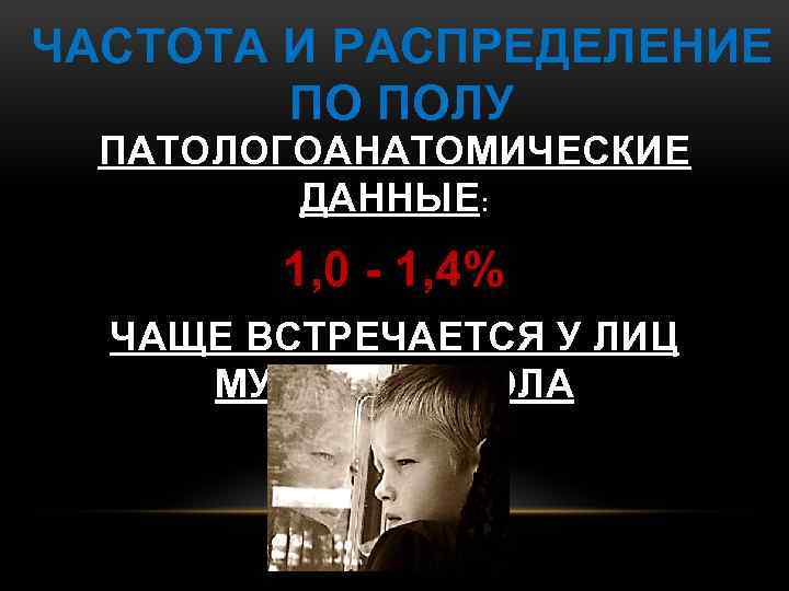 ЧАСТОТА И РАСПРЕДЕЛЕНИЕ ПО ПОЛУ ПАТОЛОГОАНАТОМИЧЕСКИЕ ДАННЫЕ: 1, 0 - 1, 4% ЧАЩЕ ВСТРЕЧАЕТСЯ