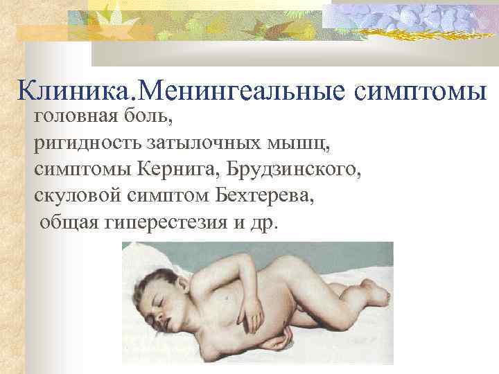 Клиника. Менингеальные симптомы головная боль, ригидность затылочных мышц, симптомы Кернига, Брудзинского, скуловой симптом Бехтерева,