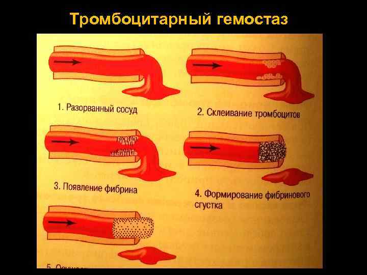 Тромбоцитарный гемостаз 