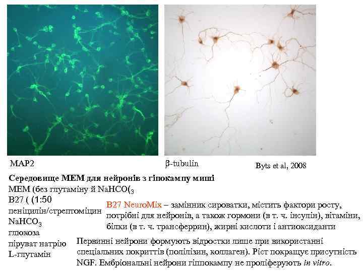 MAP 2 b-tubulin Byts et al, 2008 Середовище MEM для нейронів з гіпокампу миші