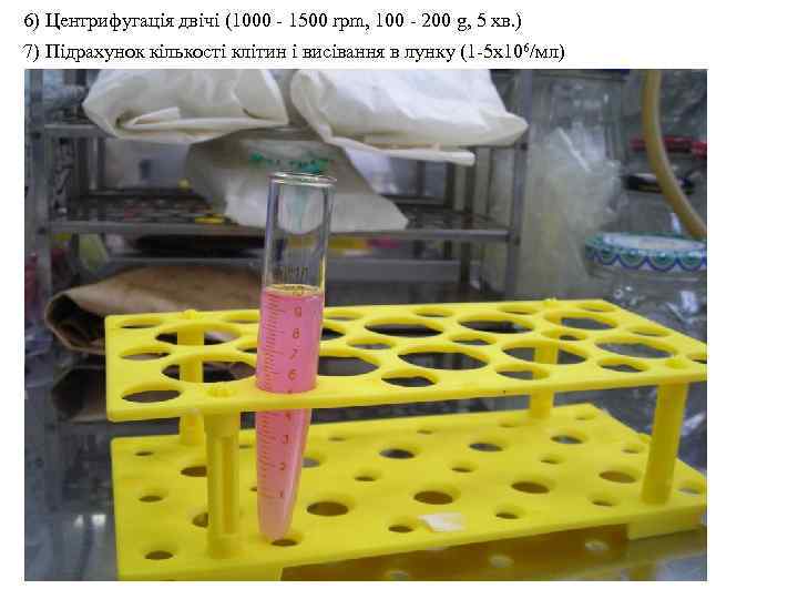 6) Центрифугація двічі (1000 - 1500 rpm, 100 - 200 g, 5 хв. )