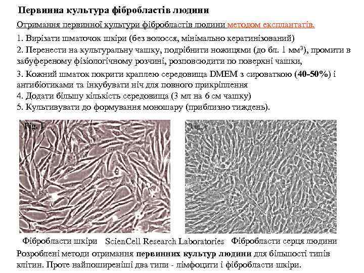 Первинна культура фібробластів людини Отримання первинної культури фібробластів людини методом експлантатів. 1. Вирізати шматочок