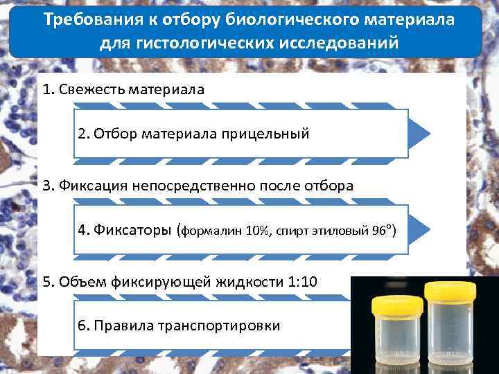 Требования к отбору биологического материала для гистологических исследований 1. Свежесть материала 2. Отбор материала