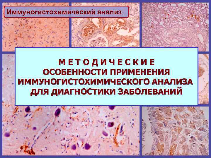 Иммуногистохимический анализ: МЕТОДИЧЕСКИЕ ОСОБЕННОСТИ ПРИМЕНЕНИЯ ИММУНОГИСТОХИМИЧЕСКОГО АНАЛИЗА ДЛЯ ДИАГНОСТИКИ ЗАБОЛЕВАНИЙ 