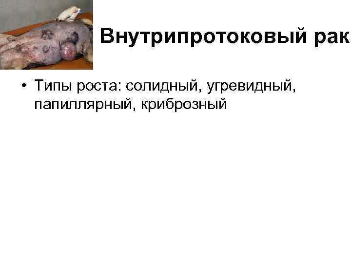 Внутрипротоковый рак • Типы роста: солидный, угревидный, папиллярный, криброзный 