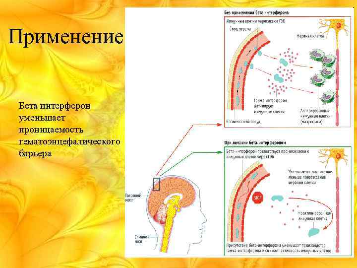 Применение Бета интерферон уменьшает проницаемость гематоэнцефалического барьера 