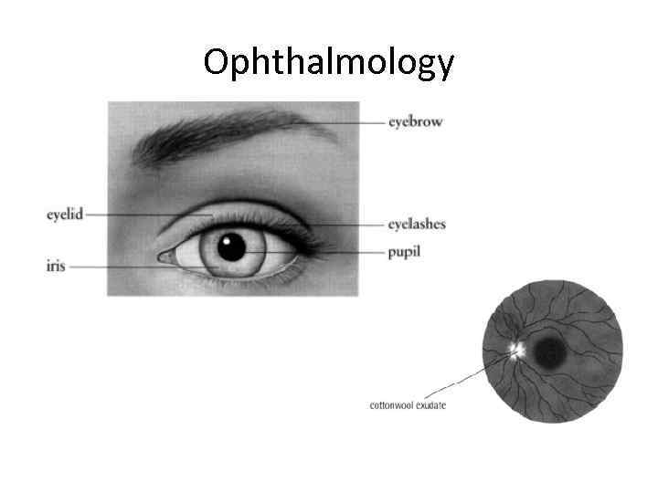 Ophthalmology 