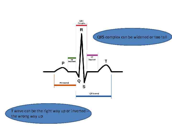 QRS complex can be widened or too tall T wave can be the right