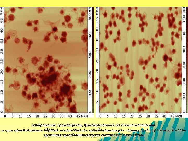 изображение тромбоцитов, фиксированных на стекле метанолом. а -для приготовления образца использовался тромбоконцентрат первых суток