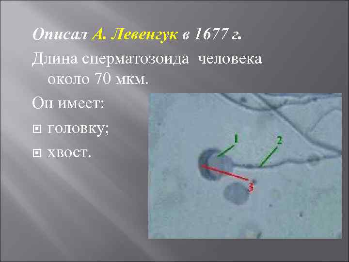 Описал А. Левенгук в 1677 г. Длина сперматозоида человека около 70 мкм. Он имеет: