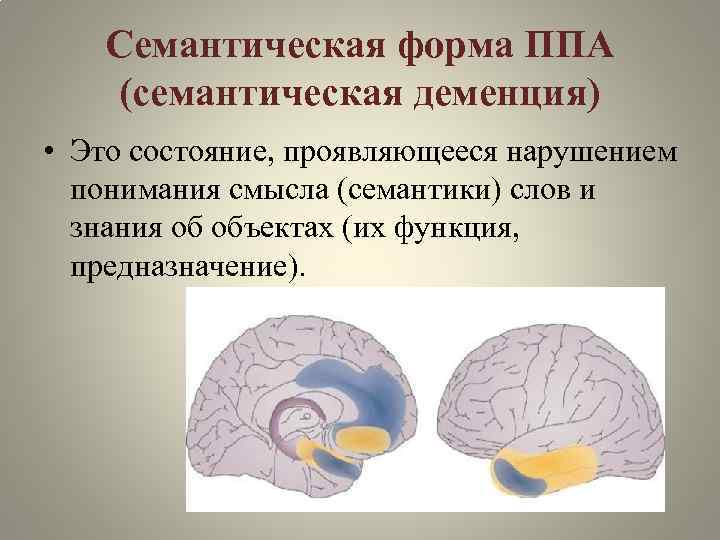 Семантическая форма ППА (семантическая деменция) • Это состояние, проявляющееся нарушением понимания смысла (семантики) слов