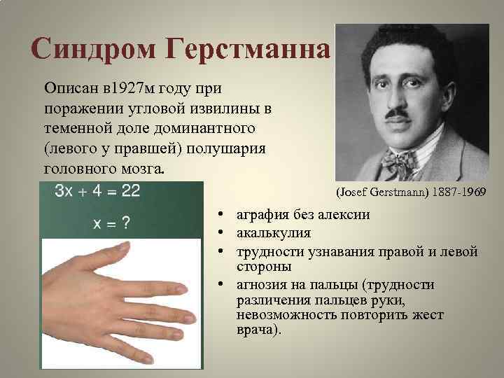 Синдром Герстманна Описан в 1927 м году при поражении угловой извилины в теменной доле