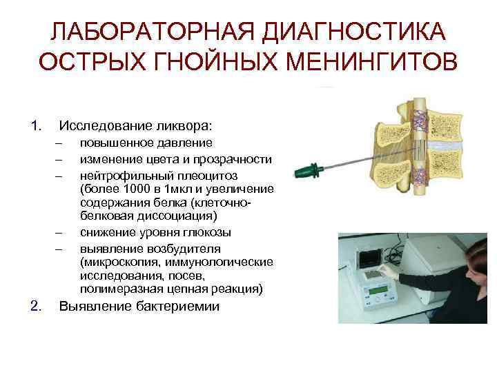 ЛАБОРАТОРНАЯ ДИАГНОСТИКА ОСТРЫХ ГНОЙНЫХ МЕНИНГИТОВ 1. Исследование ликвора: – – – 2. повышенное давление