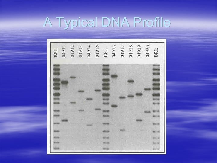 A Typical DNA Profile 