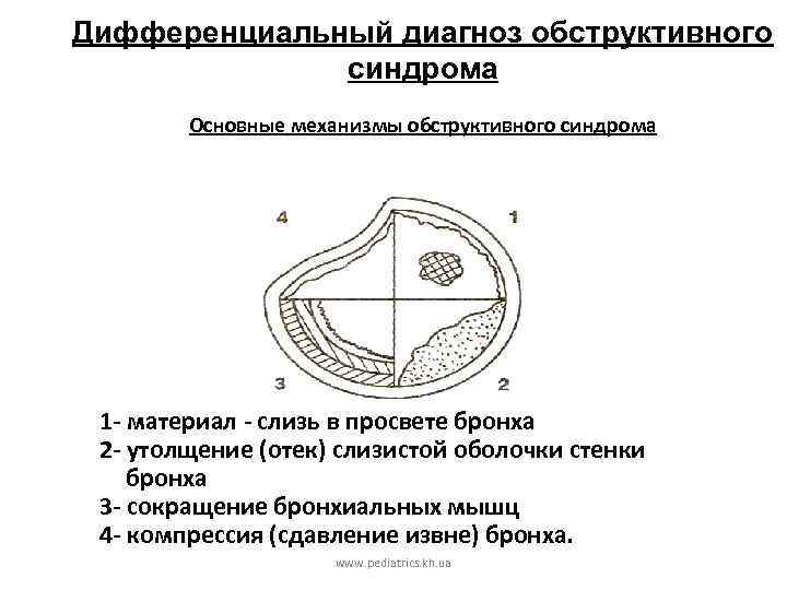 Дифференциальный диагноз обструктивного синдрома Основные механизмы обструктивного синдрома 1 - материал - слизь в