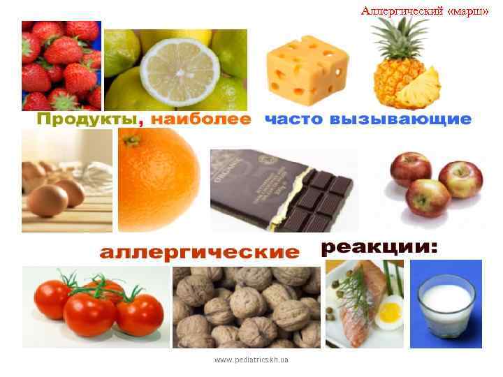Аллергический «марш» www. pediatrics. kh. ua 