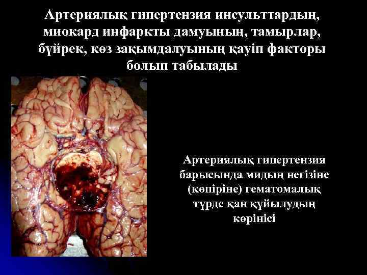 Артериялық гипертензия инсульттардың, миокард инфаркты дамуының, тамырлар, бүйрек, көз зақымдалуының қауіп факторы болып табылады