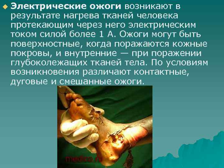 u Электрические ожоги возникают в результате нагрева тканей человека протекающим через него электрическим током