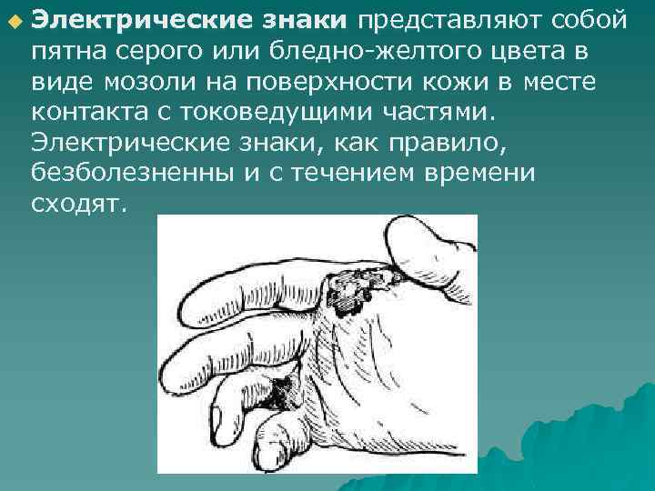 u Электрические знаки представляют собой пятна серого или бледно-желтого цвета в виде мозоли на