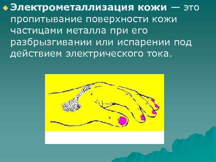 u Электрометаллизация кожи — это пропитывание поверхности кожи частицами металла при его разбрызгивании или