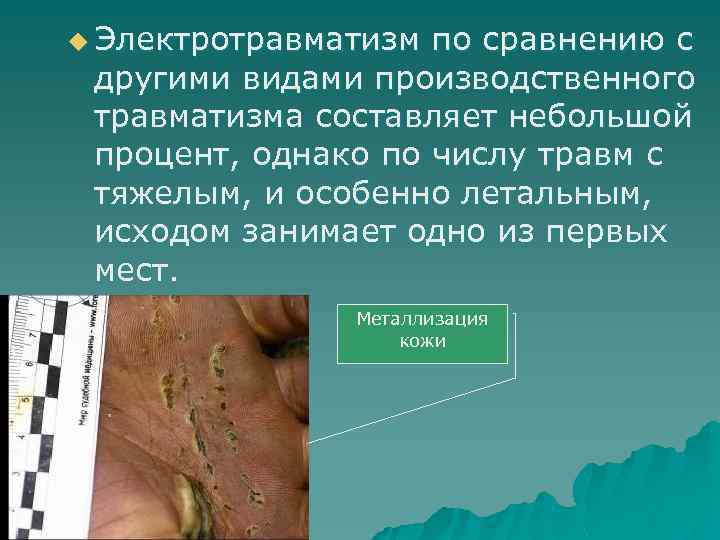 u Электротравматизм по сравнению с другими видами производственного травматизма составляет небольшой процент, однако по