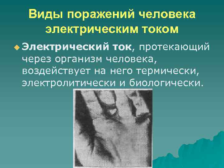 Виды поражений человека электрическим током u Электрический ток, протекающий через организм человека, воздействует на