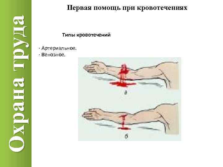 Охрана труда Первая помощь при кровотечениях Типы кровотечений · Артериальное. · Венозное. 