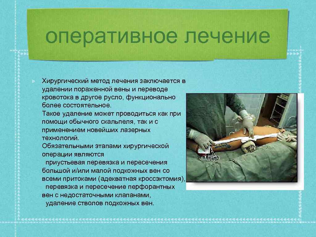 оперативное лечение Хирургический метод лечения заключается в удалении пораженной вены и переводе кровотока в