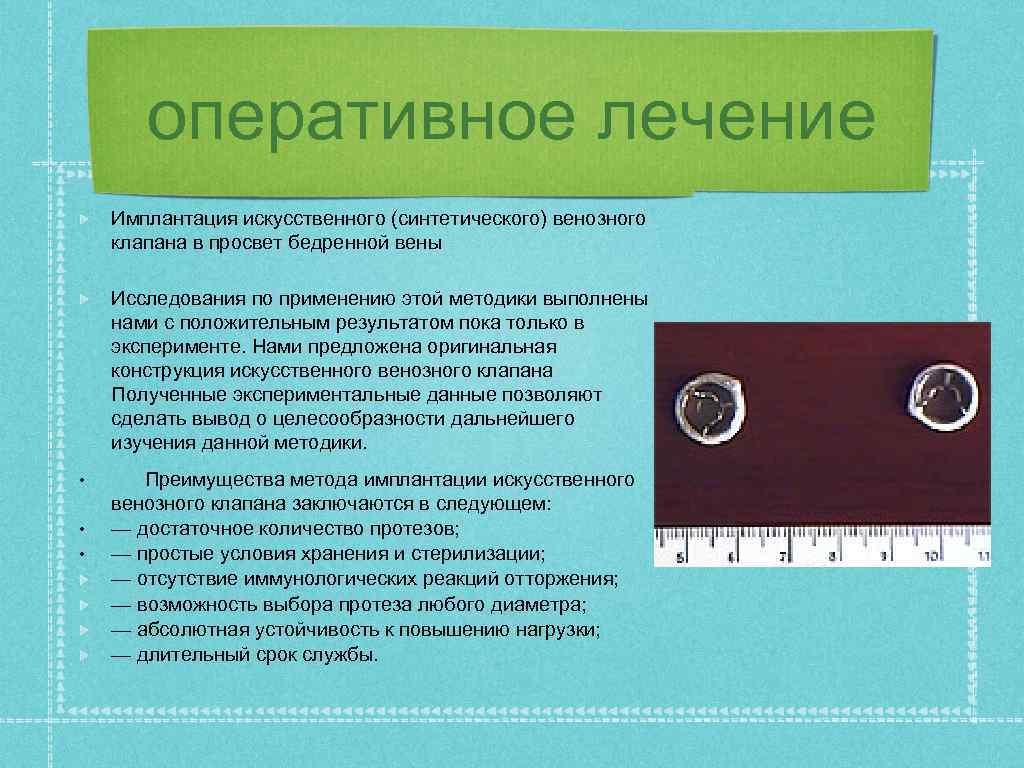 оперативное лечение Имплантация искусственного (синтетического) венозного клапана в просвет бедренной вены Исследования по применению