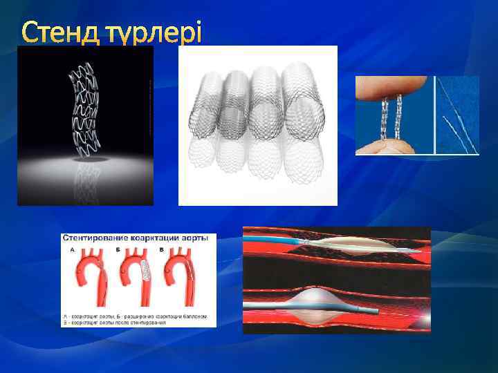 Стенд түрлері 