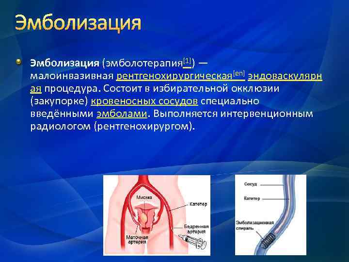 Эмболизация (эмболотерапия[1]) — малоинвазивная рентгенохирургическая[en] эндоваскулярн ая процедура. Состоит в избирательной окклюзии (закупорке) кровеносных