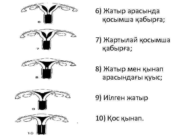 6) Жатыр арасында қосымша қабырға; 7) Жартылай қосымша қабырға; 8) Жатыр мен қынап арасындағы