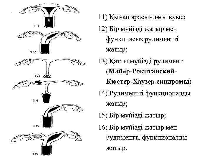 Синдром рокитанского кюстнера майера хаузера