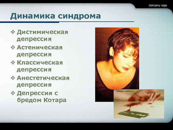 Company Logo Динамика синдрома v Дистимическая депрессия v Астеническая депрессия v Классическая депрессия v