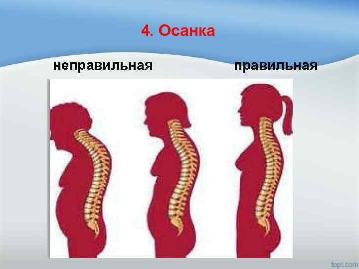 4. Осанка неправильная 