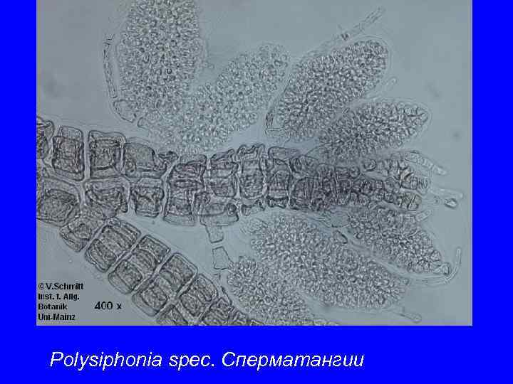 Polysiphonia spec. Сперматангии 