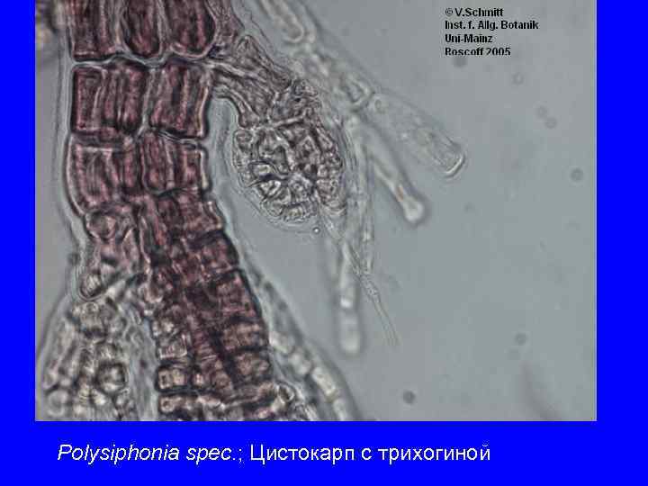 Polysiphonia spec. ; Цистокарп с трихогиной 