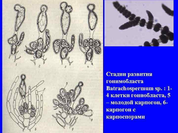 Стадии развития гонимобласта Batrachospermum sp. : 14 клетки гониобласта, 5 – молодой карпогон, 6