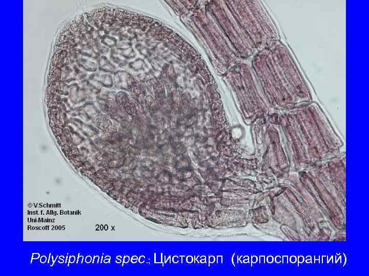 Polysiphonia spec. ; Цистокарп (карпоспорангий) 
