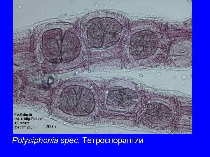 Polysiphonia spec. Тетроспорангии 
