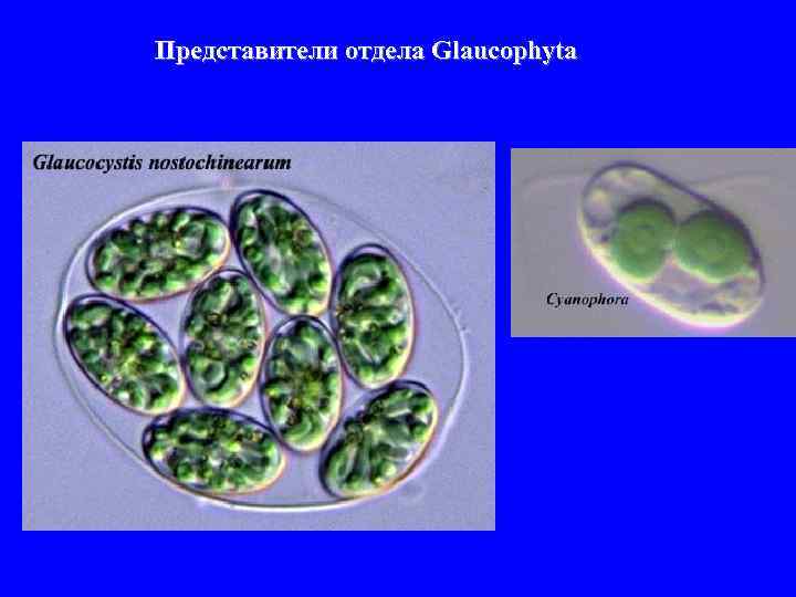 Представители отдела Glaucophyta 