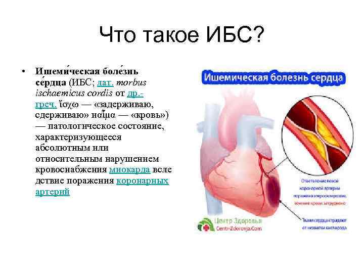 Что такое ИБС? • Ишеми ческая боле знь се рдца (ИБС; лат. morbus ischaemicus