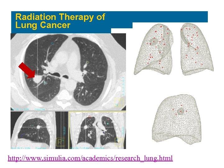 Radiation Therapy of Lung Cancer http: //www. simulia. com/academics/research_lung. html 