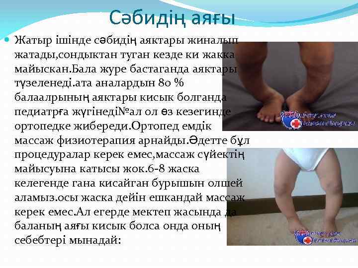 Сәбидің аяғы Жатыр ішінде сәбидің аяктары жиналып жатады, сондыктан туган кезде ки жакка майыскан.